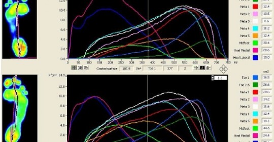 Szkolenie: „Biomechanika chodu w ujęciu badań pedobarograficznych. Zastosowanie wkładek Formthotics w dysfunkcjach stopy.”