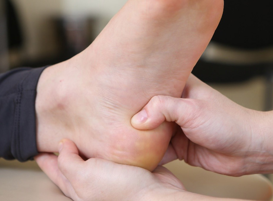 Rehabilitacja zapalenia rozcięgna podeszwowego (tzw. ostroga piętowa)