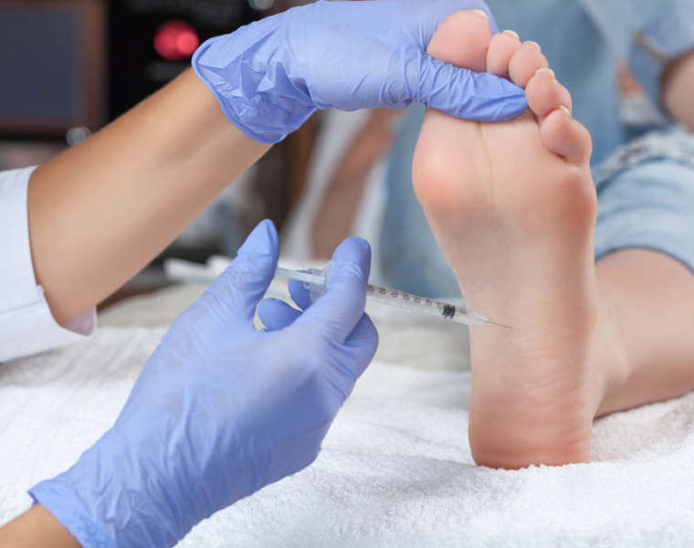 The doctor makes intramuscular injections of botulinum toxinon t The doctor makes intramuscular injections of botulinum toxinon the feet of a woman against hyperhidrosis.