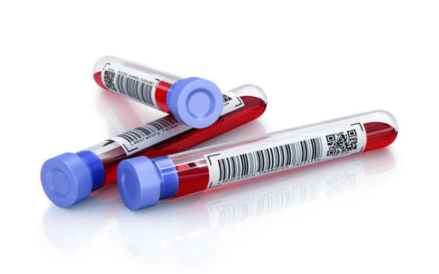 Medical test tubes with blood in holder on white background